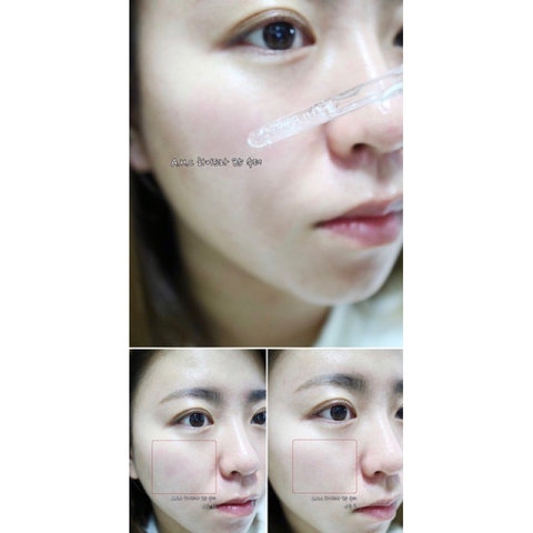 TINH CHẤT CẤP NƯỚC, LÀM DỊU DA AHC PREMIUM EX HYDRA B5 SOOTHER 30ML - GDN