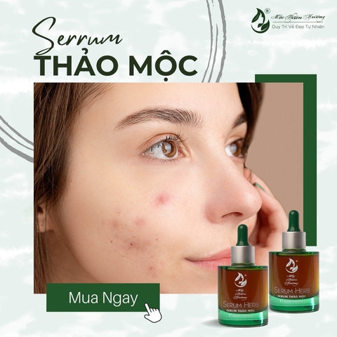 SERUM DÀNH CHO DA MỤN HERBAL ANTI 100ML - ACNE SERUM