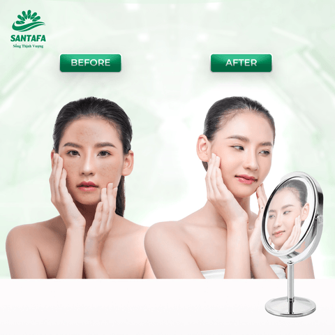 SỮA RỬA MẶT ACNEVIR SANTAFA CHIẾT XUẤT KEO ONG XANH THIÊN NHIÊN, AN TOÀN, DÀNH CHO MỌI LOẠI DA 100GR - SANTAFA