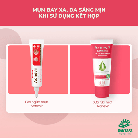 KEM GIẢM MỤN ĐẦU ĐEN, MỤN CÁM ACNEVIR SANTAFA THÀNH PHẦN THIÊN NHIÊN TUÝP 10GR - SANTAFA
