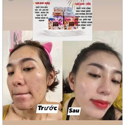 BỘ ĐÔI KEM DƯỠNG DAEMEJINE NGÀY ĐÊM HÀN QUỐC DƯỠNG TRẮNG DA HẾT MỤN NÁM TÀN NHANG KT1
