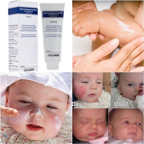 KEM DƯỠNG ẨM, GIẢM NẺ, CHÀM DA GLYCEROL 250G NỘI ĐỊA PHÁP - LABORATOIRES PIERRE FABRE