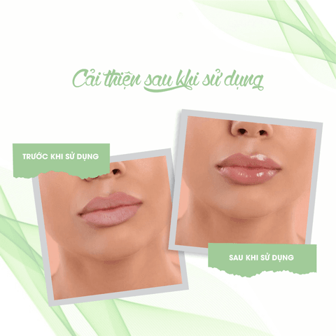 SON DƯỠNG MÔI LIP BALM -FIXDERMA ( TUÝP 15ML)