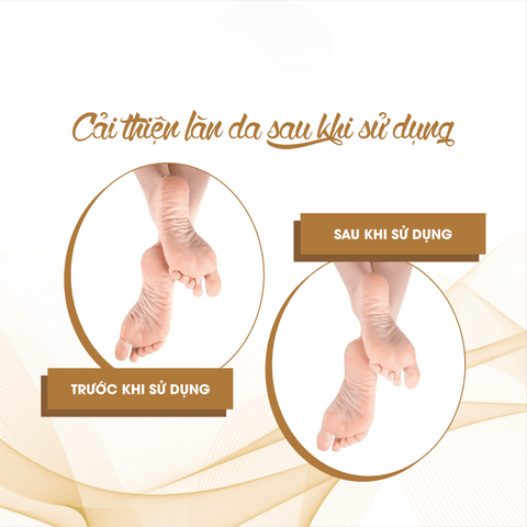 KEM MỀM GÓT CHÂN FOOT CREAM - FIXDERMA TUÝP 60 G