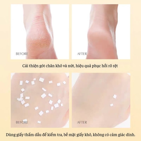GEL BÔI NỨT GÓT CHÂN HEYXI 30GR - GDN