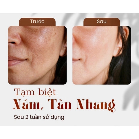 KEM SILEX NGÀY & ĐÊM THÂM NÁM SẠM TÀN NHANG LÀM TRẮNG DA MỜ NẾP NHĂN - GDN