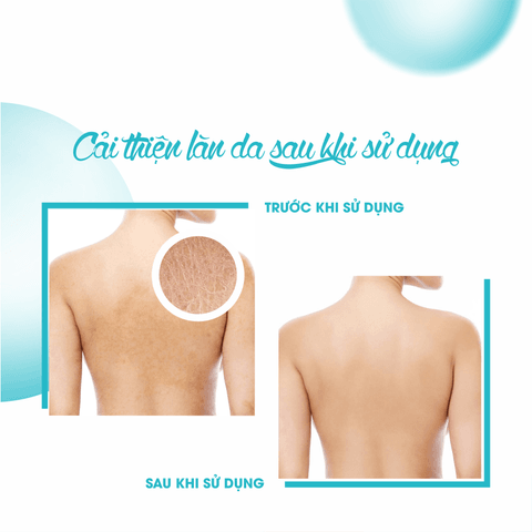 KEM DƯỠNG ẨM GIÚP DA MỀM MẠI MOISTURIZING CREAM - FIXDERMA TUÝP 60G
