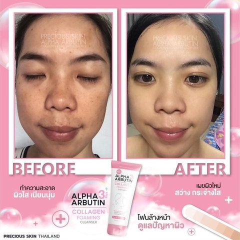 SỮA RỬA MẶT TRẮNG DA NGĂN NGỪA MỤN ALPHA ARBUTIN LOLLAGEN FOAMING CLEANSER THÁI LAN 120ML - GDN