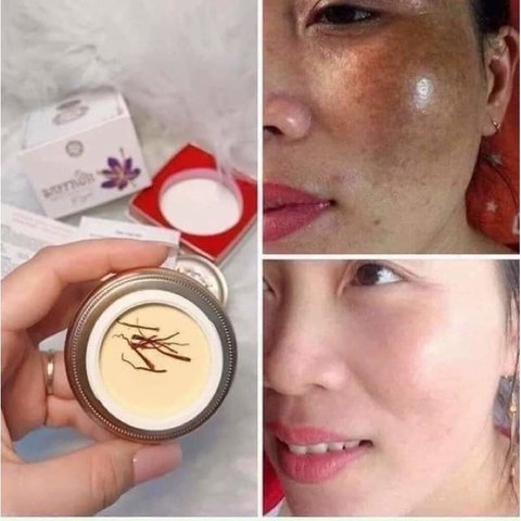 KEM NÁM SAFFRON HẢI ÂU VIỆT 20GR CHÍNH HÃNG - GDN