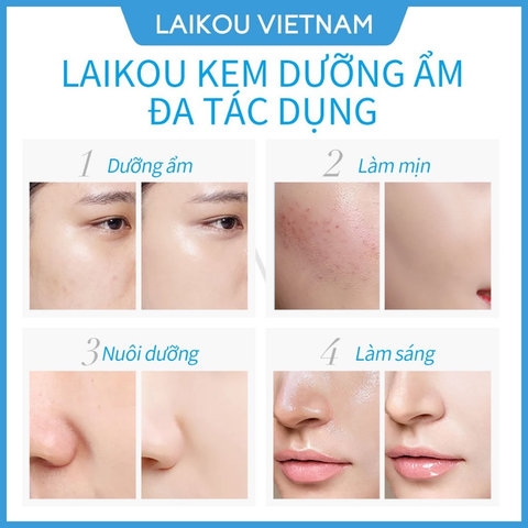KEM DƯỠNG ẨM TRẮNG DA CHỐNG NHĂN LAIKOU MOISTURIZING CREAM 50G