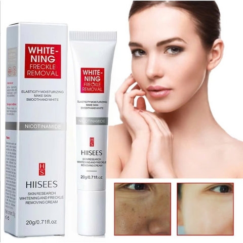 KEM BÔI NÁM HIISEES DƯỠNG ẨM TRẮNG DA, MỜ THÂM NÁM TÀN NHANG WHITE NING - GDN