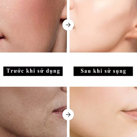 [HỘP 1 LỌ] TONER CÂN BẰNG 8 LỚP TRẮNG SÁNG DA MẶT TERISA SAKURA WHITENING DAVE TONER CHIẾT XUẤT HOA ANH ĐÀO DƯỠNG ẨM DA MẶT