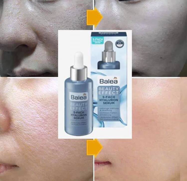 SERUM CẤP ẨM BEAUTY HYALURON 7-FACH ĐỨC 30ML - BALEA