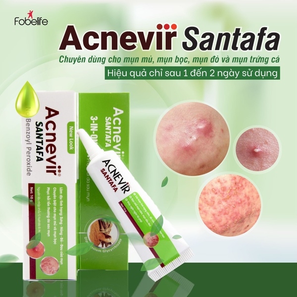 COMBO TRỊ MỤN SỮA RỬA MẶT 100G + KEM MỤN XANH 10G + KEM TRỊ THÂM 15G - FOBELIFE