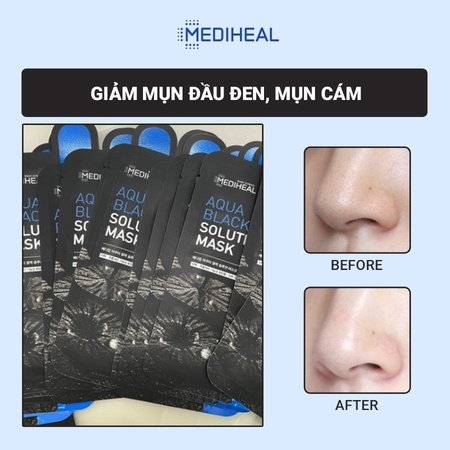 MẶT NẠ THAN HOẠT TÍNH SE KHÍT LỖ CHÂN LÔNG AQUA BLACK SOLUTION MASK 23ML - MEDIHEAL