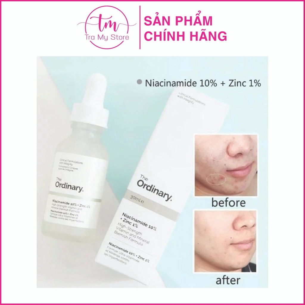 TINH CHẤT TRỊ MỤN, GIẢM THÂM NIACINAMIDE 10 + ZINC 1 - THE ORDINARY