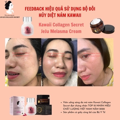 VIÊN UỐNG SÁNG DA COLLAGEN TẶNG KEM DƯỠNG DA 30G - KAWAII