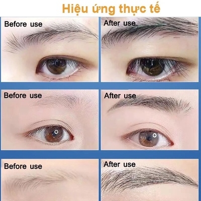 DƯỠNG MÀY FKN - MỌC LÔNG MÀY DÀI, DÀY, CHẮC KHỎE CỰC HIỆU QUẢ - MỸ PHẨM 24H