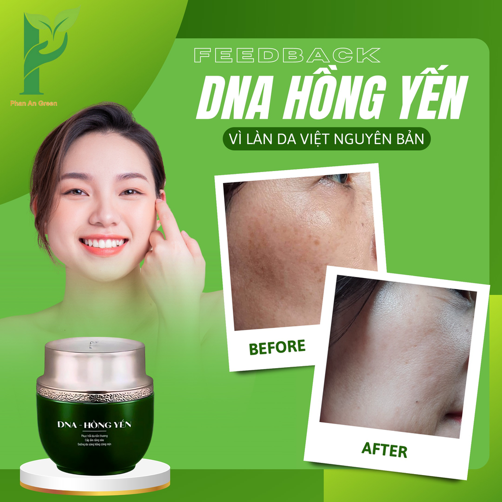 [TẶNG KÈM 1 KEM CHỐNG NẮNG SINH HỌC NINE'S BEAUTY] KEM DƯỠNG DA DNA HỒNG YẾN - PHỤC HỒI, CẤP ẨM, TRẮNG HỒNG & MỊN MÀNG - PHAN AN GREEN