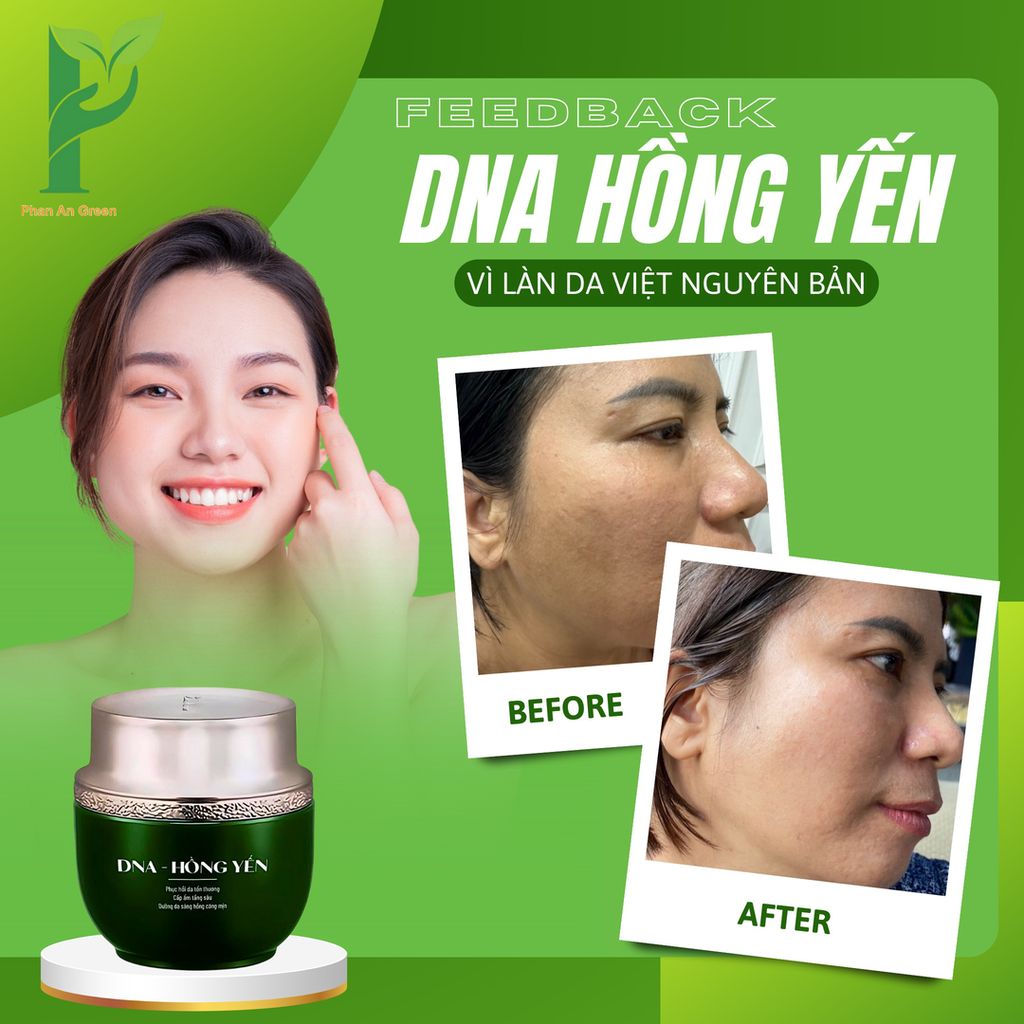 [TẶNG KÈM 1 KEM CHỐNG NẮNG SINH HỌC NINE'S BEAUTY] KEM DƯỠNG DA DNA HỒNG YẾN - PHỤC HỒI, CẤP ẨM, TRẮNG HỒNG & MỊN MÀNG - PHAN AN GREEN