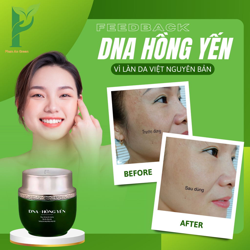 TẶNG KÈM 1 KEM CHỐNG NẮNG SINH HỌC NINE'S BEAUTY] KEM DƯỠNG DA DNA HỒNG YẾN - PHỤC HỒI, CẤP ẨM, TRẮNG HỒNG & MỊN MÀNG - PHAN AN GREEN