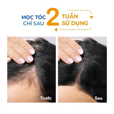 BỘ BA (GỘI + XẢ + SERUM) GIẢM RỤNG HỖ TRỢ MỌC TÓC GỒM DẦU GỘI HOA BƯỞI (250ML) & DẦU XẢ HOA BƯỞI NEO NATURE (250ML) & SERUM HOA BƯỞI 50ML- NEONATURE