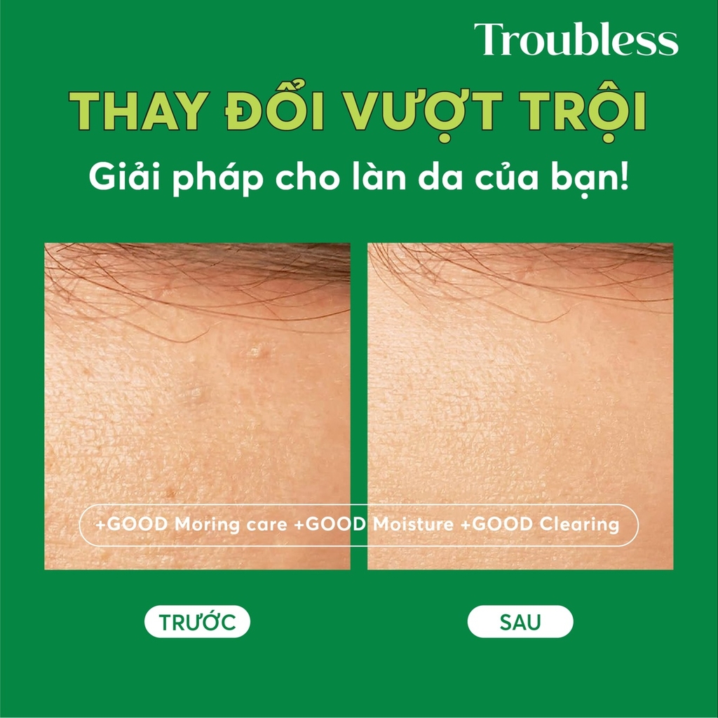 GEL RỬA MẶT TẠO BỌT TROUBLESS DỊU NHẸ HỖ TRỢ KIỂM SOÁT NHỜN MỤN, LÀM SẠCH SÂU 120ML