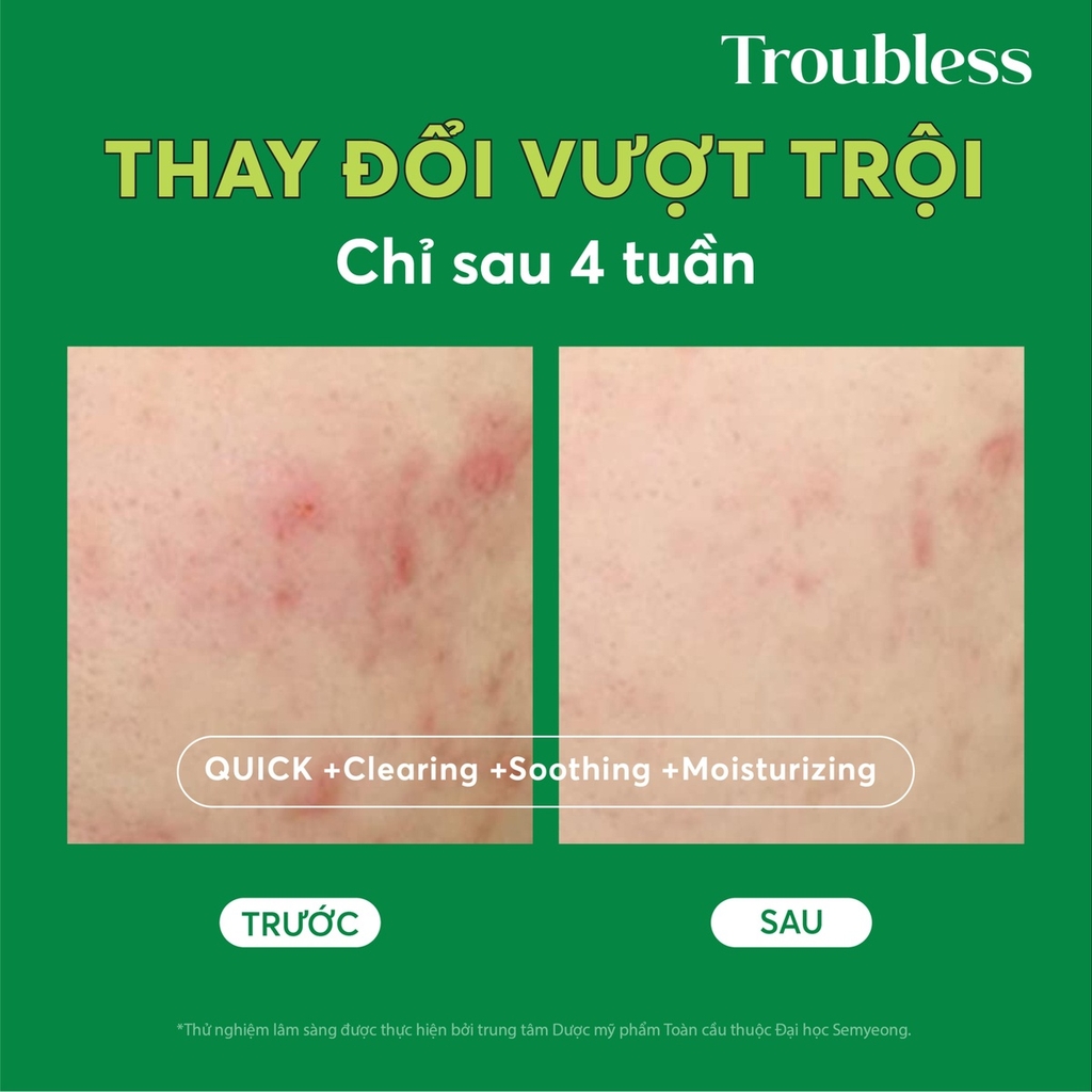 NƯỚC CÂN BẰNG TROUBLESS LÀM DỊU DA TẨY TẾ BÀO CHẾT, SÁNG DA, GIẢM MỤN 200ML