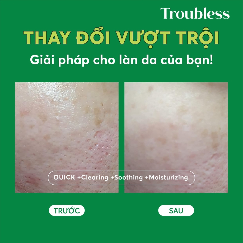 SỮA RỬA MẶT TẠO BỌT TROUBLESS DỊU NHẸ HỖ TRỢ KIỂM SOÁT NHỜN MỤN, LÀM SẠCH SÂU 120ML