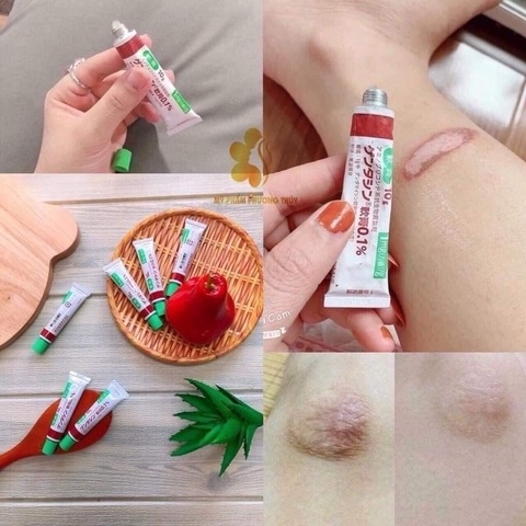 KEM TRỊ SẸO NHẬT BẢN 0.1% - GENTACIN