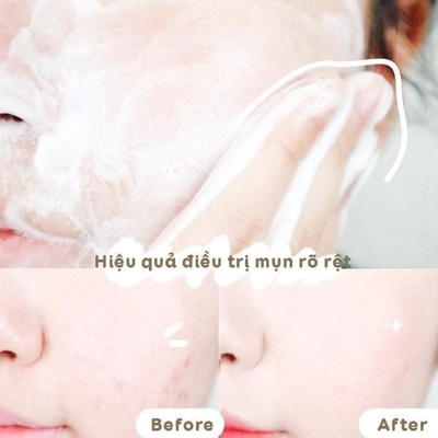 SỮA RỬA MẶT TẨY TẾ BÀO CHẾT DƯỠNG ẨM PHA 5.5 - BYVIBES WONDER