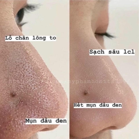 MẶT NẠ ĐẤT SÉT SẠCH SÂU SE KHÍT LỖ CHÂN LÔNG MỸ - KIEHL'S