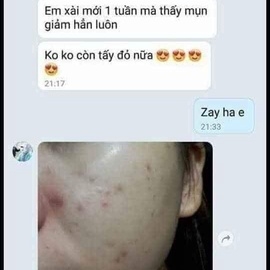 KEM MỤN DƯỠNG DA THẢO MỘC TKH - HỒNG ÁNH STORE