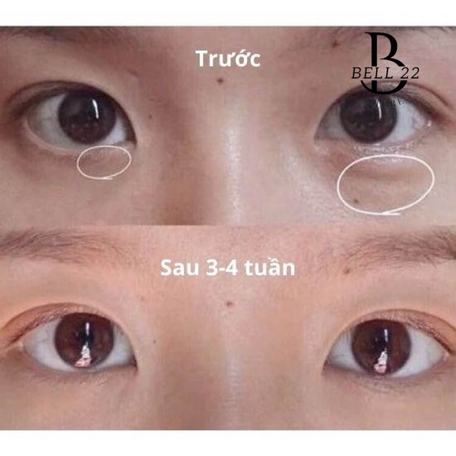 KEM MẮT COMPLIMENT PANTHENOL GIẢM THÂM BỌNG NHĂN MẮT B1031 - BELL22 STORE
