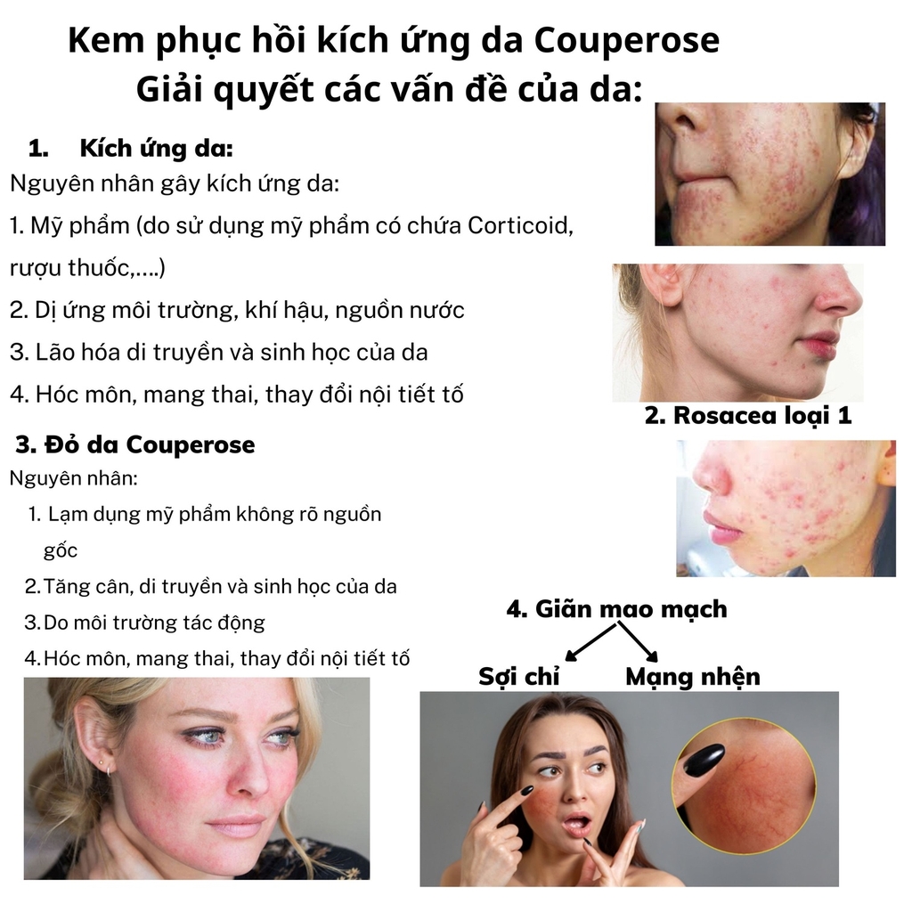 KEM PHỤC HỒI KÍCH ỨNG DA COUPEROSE 30ML - SWISSFORCE