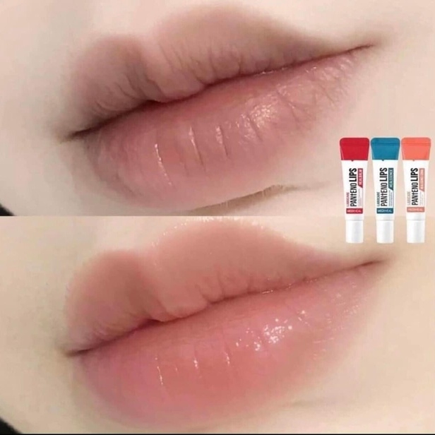 SON DƯỠNG TRỊ THÂM MÔI MEDIHEAL LABOCARE LIPS 10 ML AD377