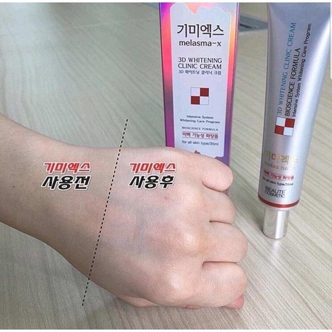 KEM NÁM 3D GIẢM THÂM NÁM TÀN NHANG MELASMA-X 3D WHITE CREAM AD416