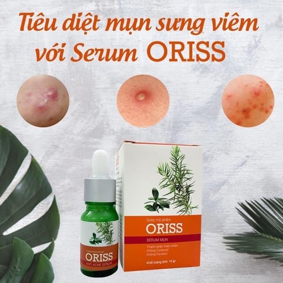 SERUM NGỪA MỤN LÀM MỜ THÂM MỤN ORISS 10G