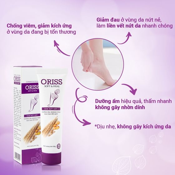 KEM TRỊ NỨT GÓT CHÂN ORISS 30G