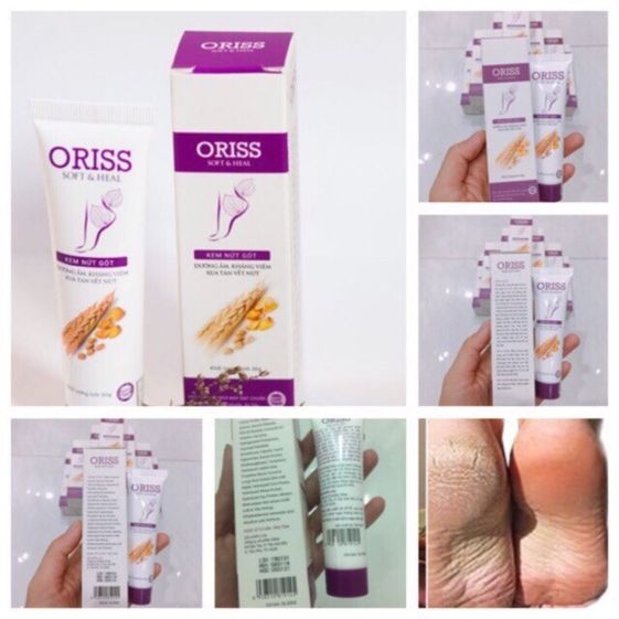 KEM TRỊ NỨT GÓT CHÂN ORISS 30G