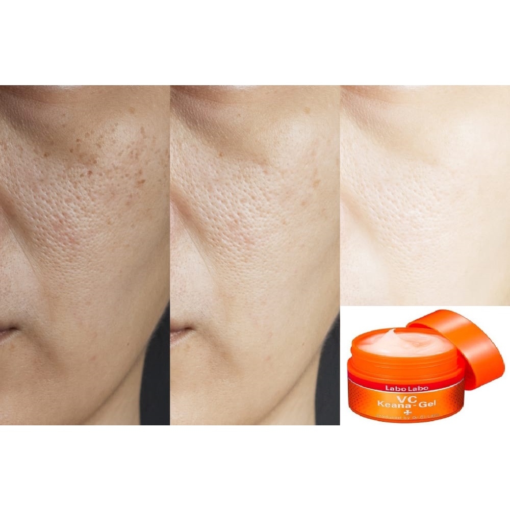 KEM DƯỠNG LABO LABO CHUYÊN TRỊ LỖ CHÂN LÔNG TO VÀ MỤN ĐẦU ĐEN