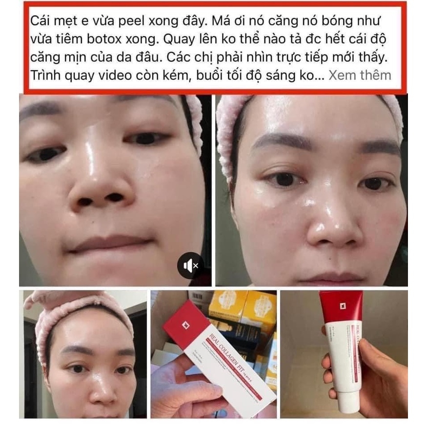 Peel da mặt collagen fit Hàn Quốc 50ml-hàn