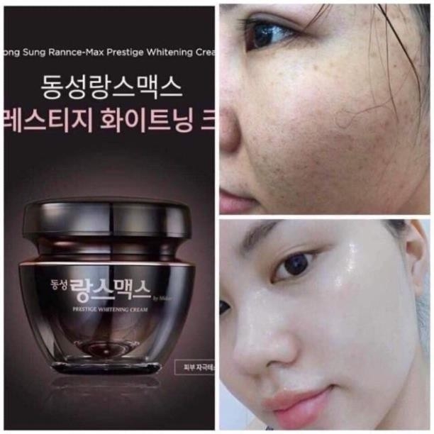 Kem trị nám Dongsung Rannce Cream Hàn Quốc 70-hàn