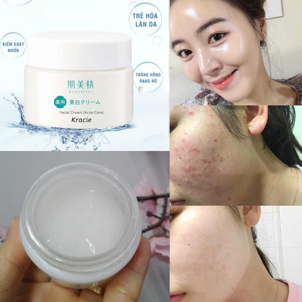 Kem dưỡng da trị mụn Kracie Nhật-nhật