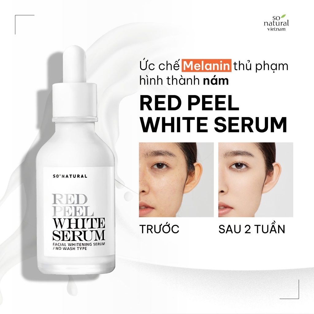 Tinh chất Thay da sinh học Red Peel Tingle Serum - 35ml-hàn