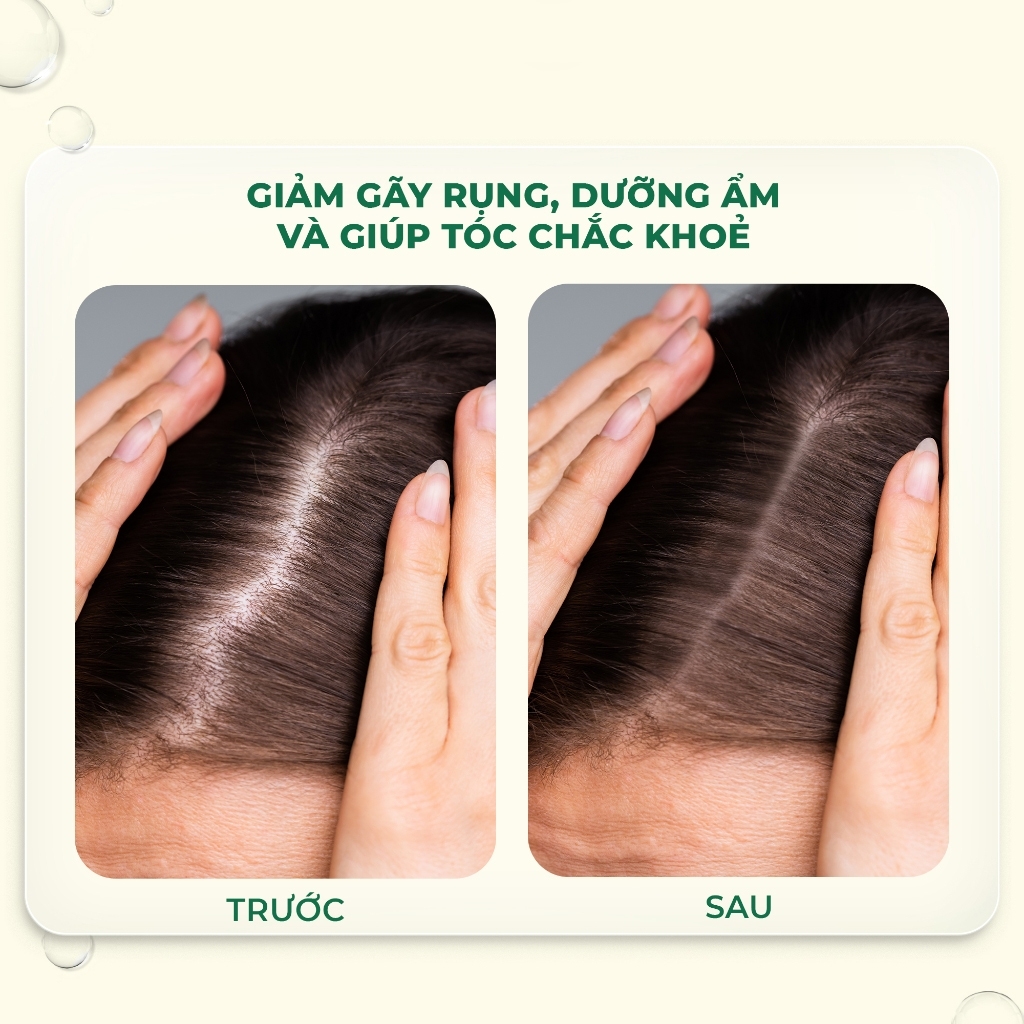 Tinh chất dưỡng tóc PURA D'OR Hair Thinning Therapy Energizing Scalp Serum organic, kích mọc tóc