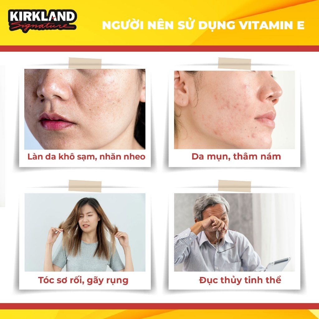 Viên uống Vitamin E MỸ Kirkland 500 viên- Mỹ