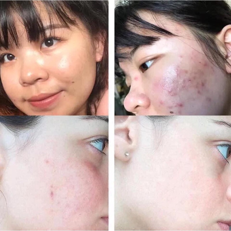 Kem dưỡng nhau thai cừu Careline-Úc