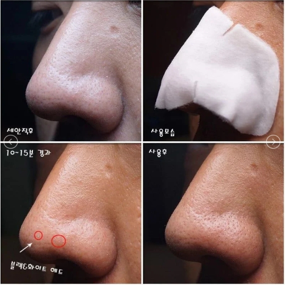 Mặt Nạ Đẩy Mụn Đầu Đen Ciracle Goodbye Blackhead (Miếng)-hàn