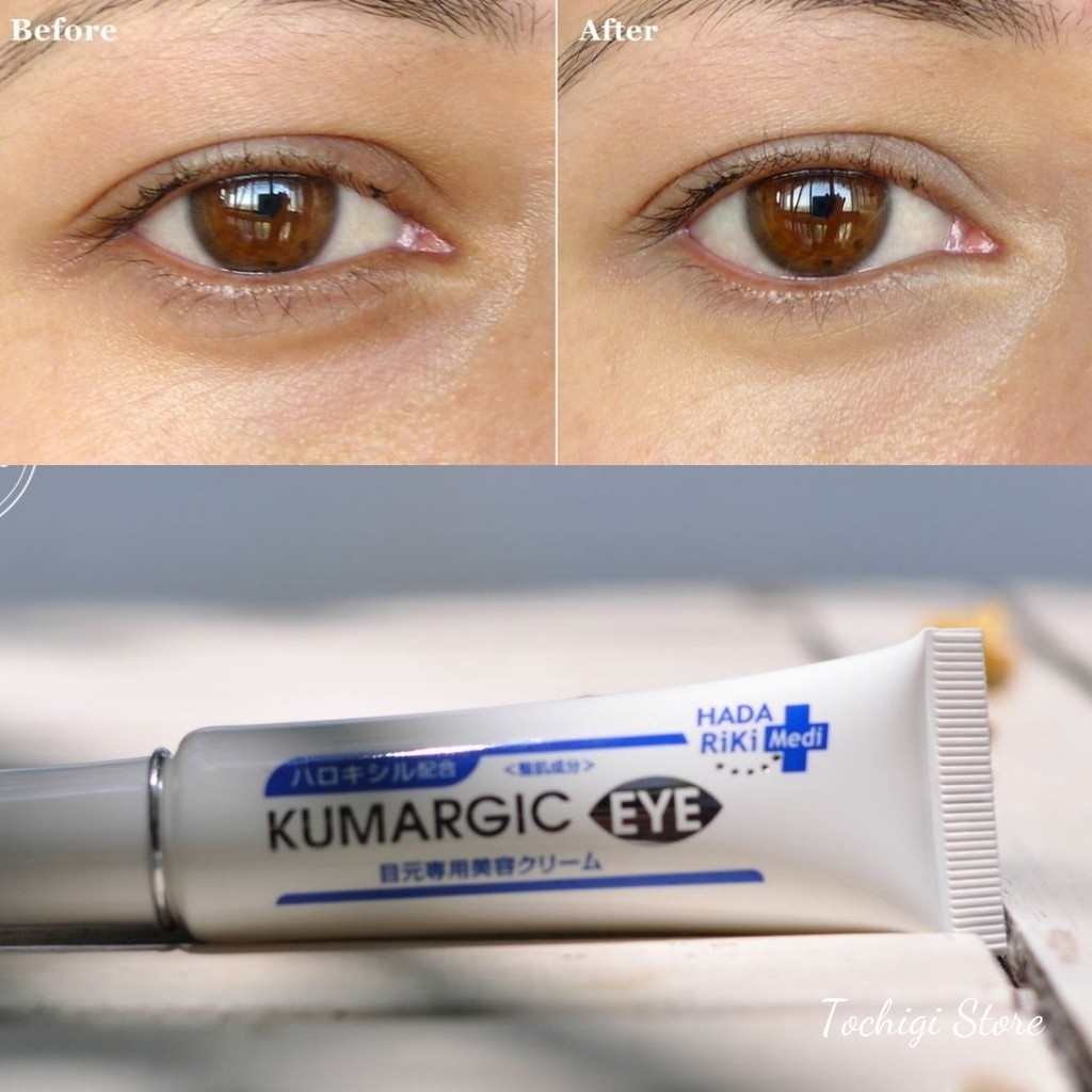 Kem mắt trị quầng thâm mắt Kumargic - Nhật